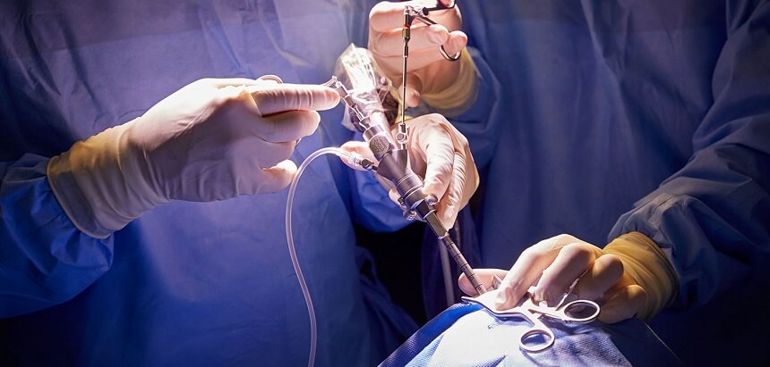 Endoscopic Neurosurgery in Pune